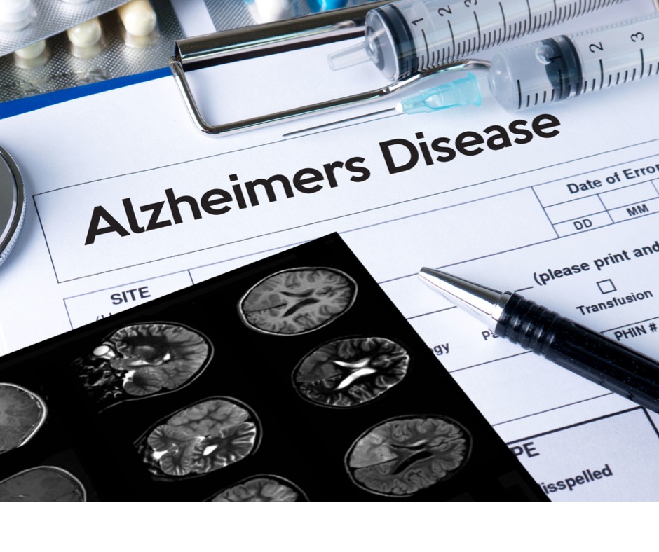 Is there a link between High Cholesterol and Alzheimer's Disease?